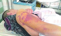 【龍口新聞】被刀架到村委,村民遭群毆——龍口網